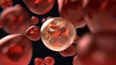 أسباب الإجهاض المبكر بعد الحقن المجهري