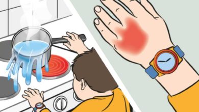 الإسعافات الأولية للأطفال