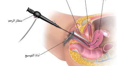 المنظار الرحمي