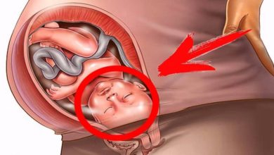 أعراض-الولادة-المبكرة