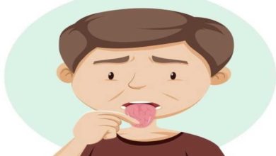 أعراض جفاف الفم والحلق
