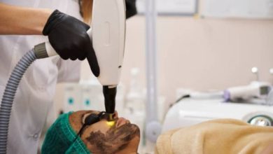 الليزر الكربوني للوجه