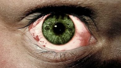 مدة شفاء خدش القرنية