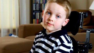 ضمور العضلات الشوكي