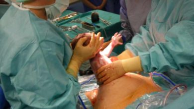 علامات الولادة