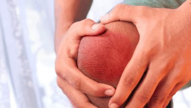 ارتشاح الركبة