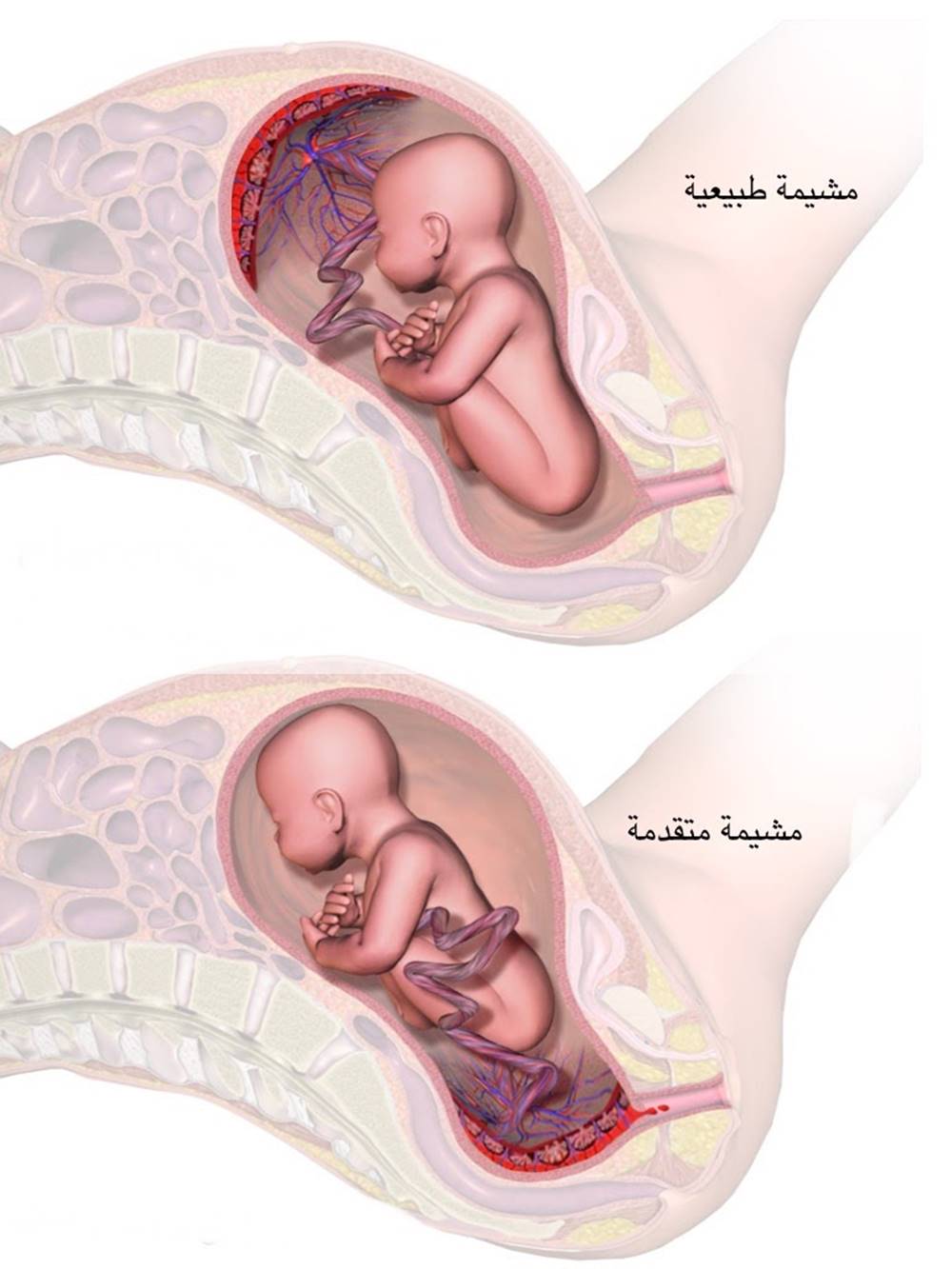 Плацента при беременности