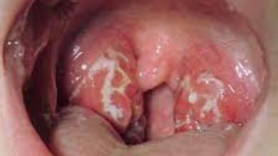 الميكروب السبحي