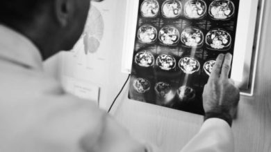 الأشعة المقطعية