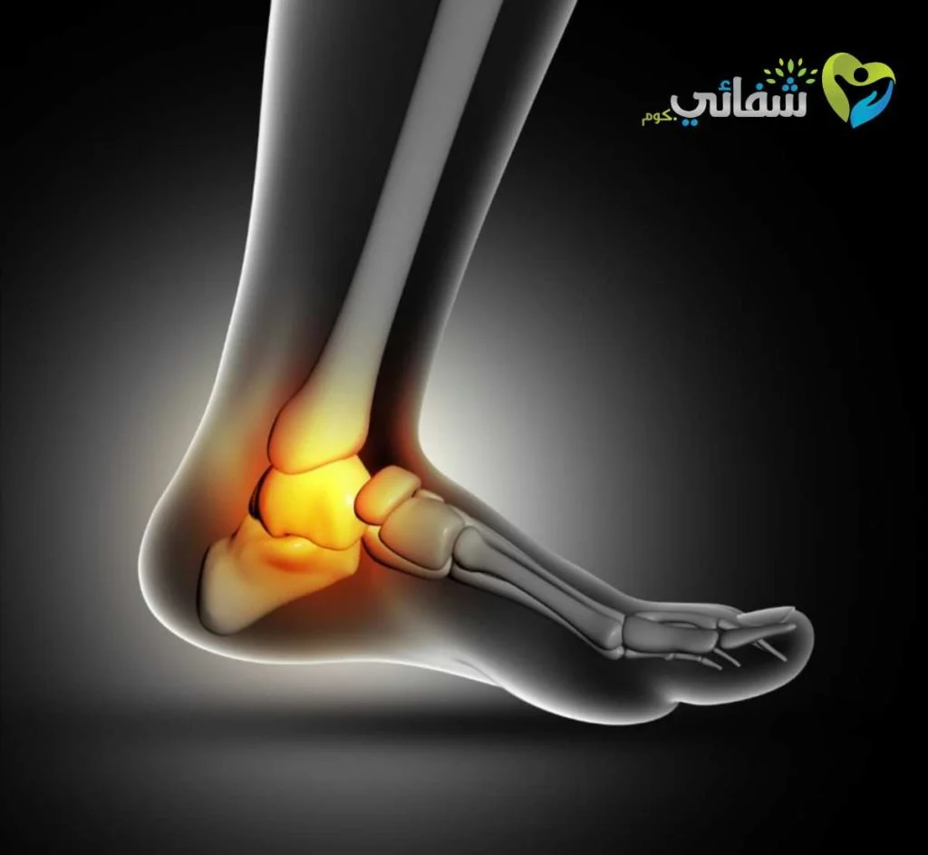 الشوكة العظمية