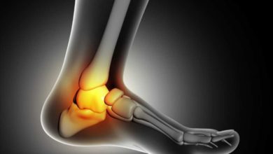 الشوكة العظمية