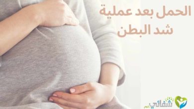 الحمل بعد عملية شد البطن