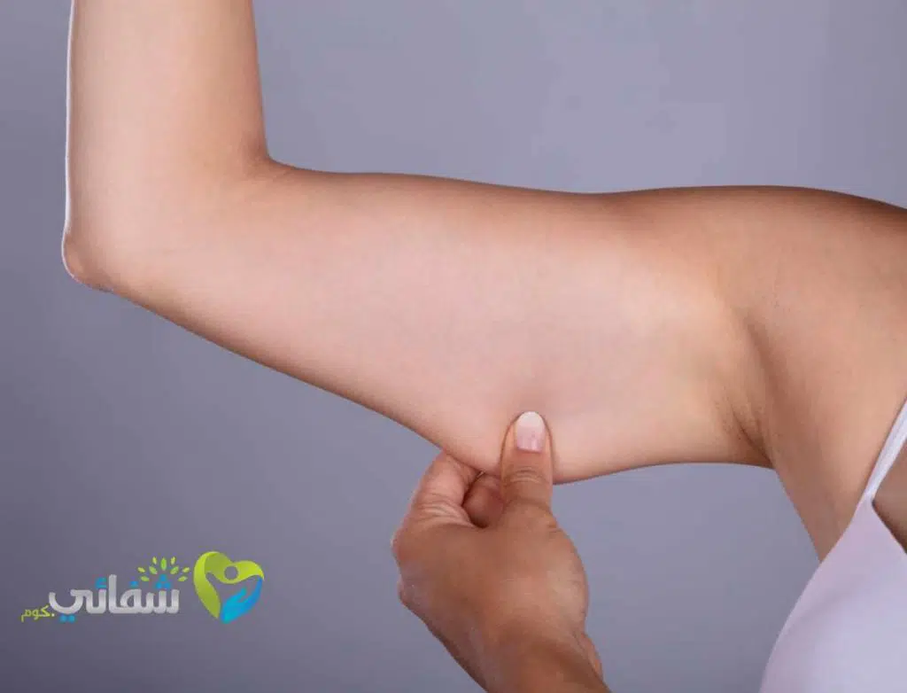 عملية شد الزنود بالفيزر