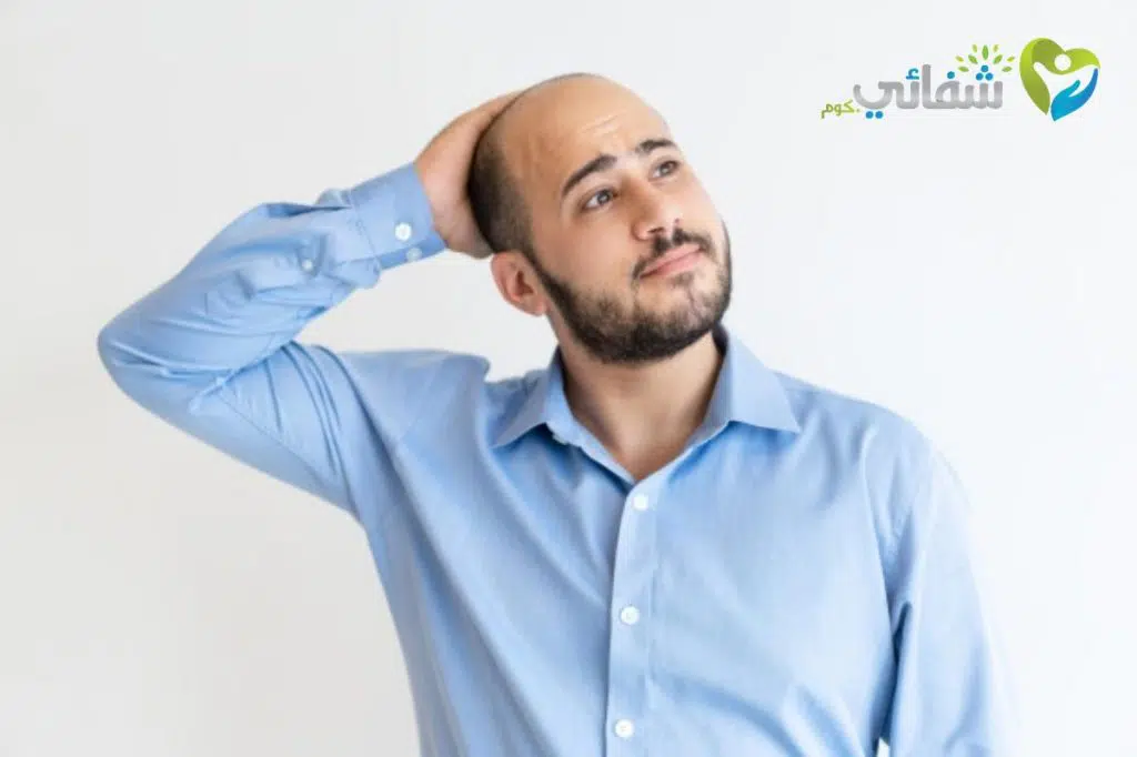 أسباب الصلع عند الرجال