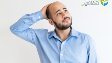 أسباب الصلع عند الرجال