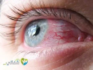 دواعي استعمال قطرة أولوبات