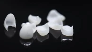 عدسات الأسنان