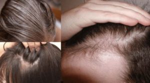 متى تظهر نتائج بخاخ افوجين