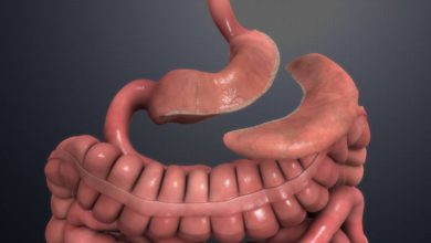 الإمساك بعد التكميم