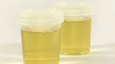 البروتين في البول للحامل