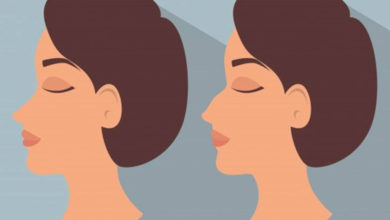 مميزات تجميل الأنف بالخيوط